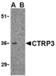 Western blot - CTRP3 Antibody from Signalway Antibody (24329) - Antibodies.com