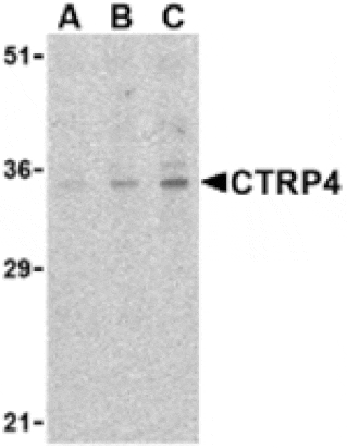 Western blot - CTRP4 Antibody from Signalway Antibody (24330) - Antibodies.com