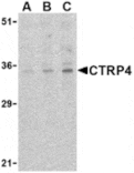 Western blot - CTRP4 Antibody from Signalway Antibody (24330) - Antibodies.com