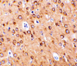 Immunohistochemistry - CTRP4 Antibody from Signalway Antibody (24330) - Antibodies.com