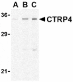 Western blot - CTRP4 Antibody from Signalway Antibody (24331) - Antibodies.com