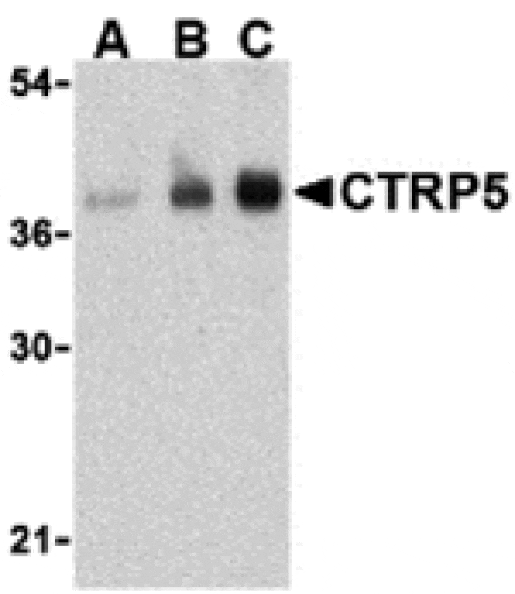 Western blot - CTRP5 Antibody from Signalway Antibody (24332) - Antibodies.com