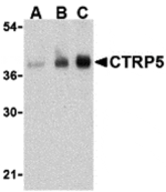 Western blot - CTRP5 Antibody from Signalway Antibody (24332) - Antibodies.com