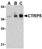 Western blot - CTRP5 Antibody from Signalway Antibody (24332) - Antibodies.com