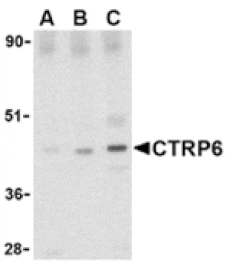 Western blot - CTRP6 Antibody from Signalway Antibody (24335) - Antibodies.com