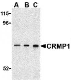 Western blot - CRMP1 Antibody from Signalway Antibody (24355) - Antibodies.com