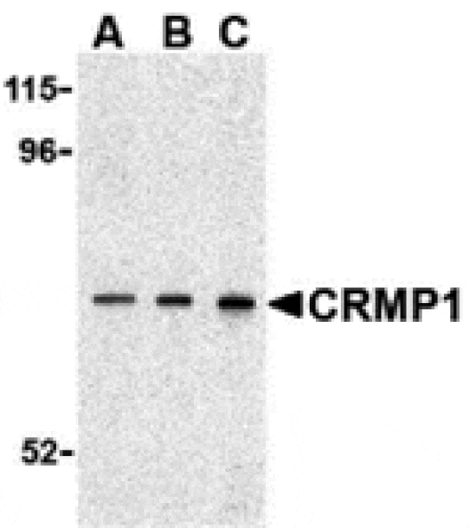 Western blot - CRMP1 Antibody from Signalway Antibody (24355) - Antibodies.com