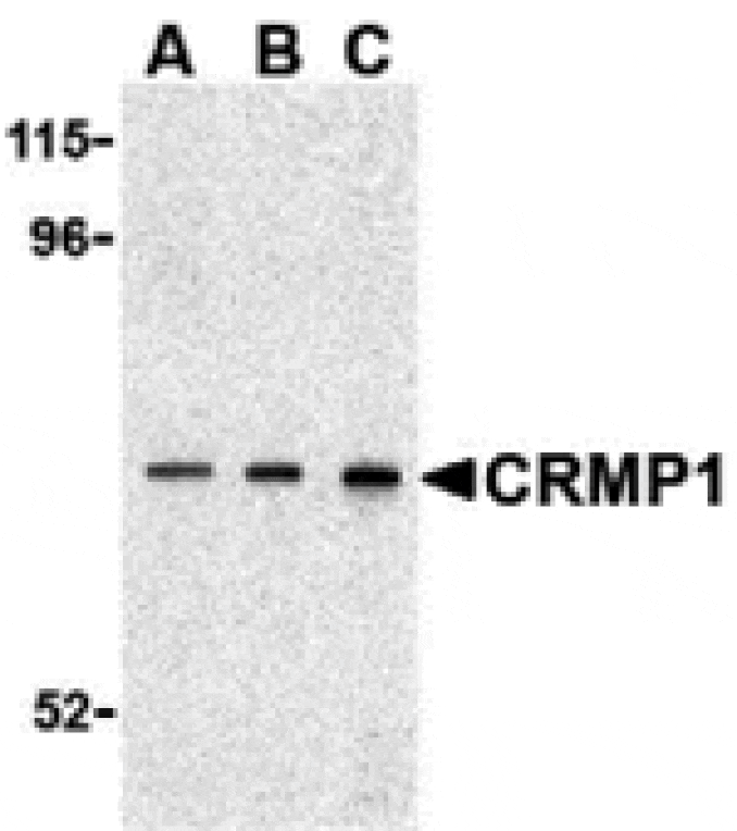 Western blot - CRMP1 Antibody from Signalway Antibody (24355) - Antibodies.com