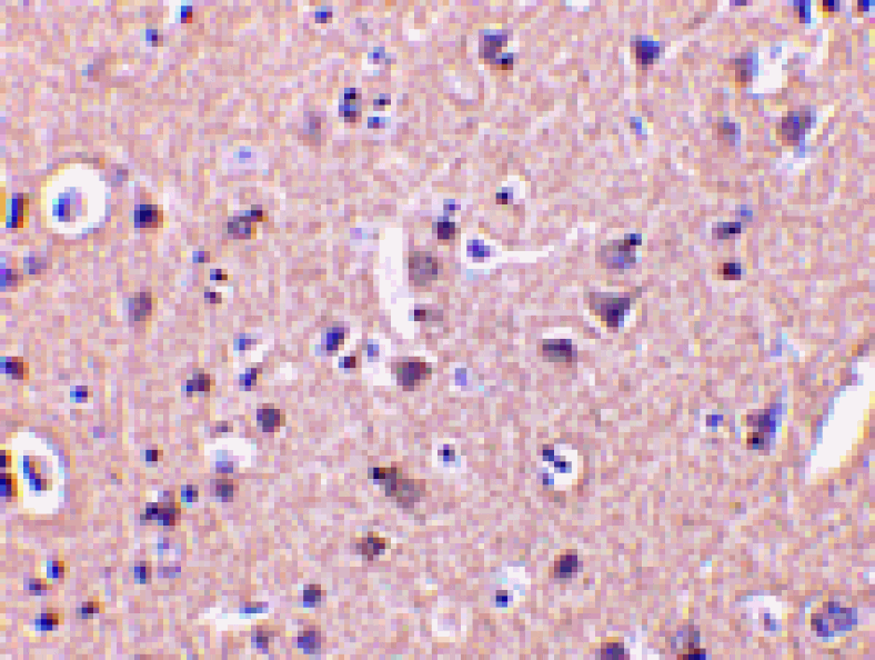 Immunohistochemistry - CRMP1 Antibody from Signalway Antibody (24355) - Antibodies.com