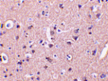 Immunohistochemistry - CRMP1 Antibody from Signalway Antibody (24355) - Antibodies.com
