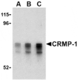 Western blot - CRMP1 Antibody from Signalway Antibody (24356) - Antibodies.com