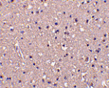 Immunohistochemistry - CRMP1 Antibody from Signalway Antibody (24356) - Antibodies.com
