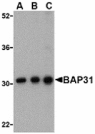 Western blot - BAP31 Antibody from Signalway Antibody (24374) - Antibodies.com