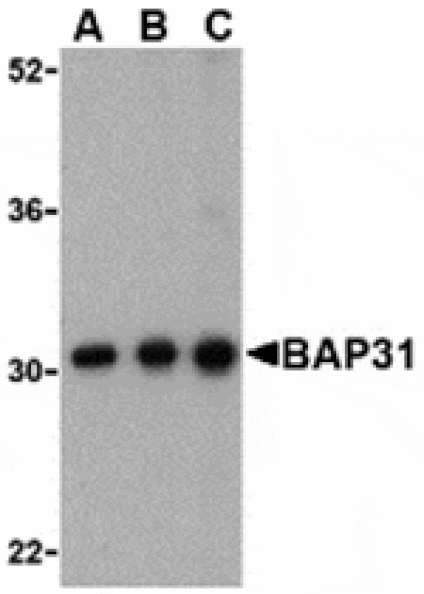 Western blot - BAP31 Antibody from Signalway Antibody (24374) - Antibodies.com