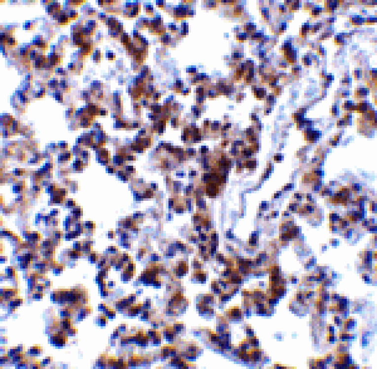 Immunohistochemistry - BAP31 Antibody from Signalway Antibody (24374) - Antibodies.com