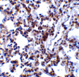 Immunohistochemistry - BAP31 Antibody from Signalway Antibody (24374) - Antibodies.com