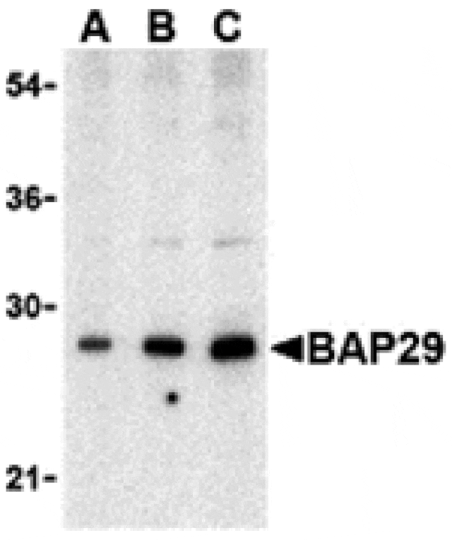 Western blot - BAP29 Antibody from Signalway Antibody (24375) - Antibodies.com