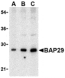 Western blot - BAP29 Antibody from Signalway Antibody (24375) - Antibodies.com