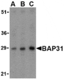 Western blot - BAP31 Antibody from Signalway Antibody (24379) - Antibodies.com