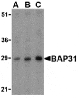 Western blot - BAP31 Antibody from Signalway Antibody (24379) - Antibodies.com