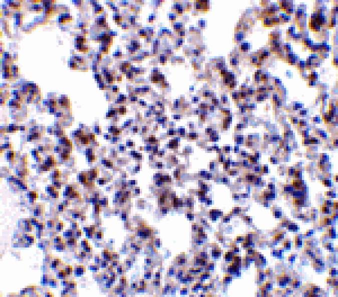 Immunohistochemistry - BAP31 Antibody from Signalway Antibody (24379) - Antibodies.com