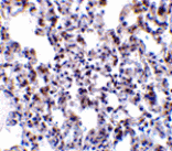 Immunohistochemistry - BAP31 Antibody from Signalway Antibody (24379) - Antibodies.com