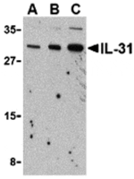 Western blot - IL-31 Antibody from Signalway Antibody (24390) - Antibodies.com