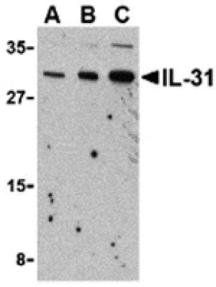 Western blot - IL-31 Antibody from Signalway Antibody (24390) - Antibodies.com