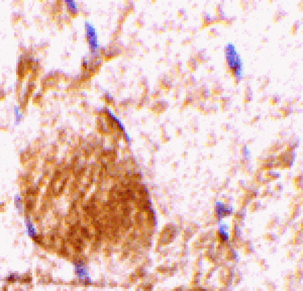 Immunohistochemistry - IL-31 Antibody from Signalway Antibody (24390) - Antibodies.com