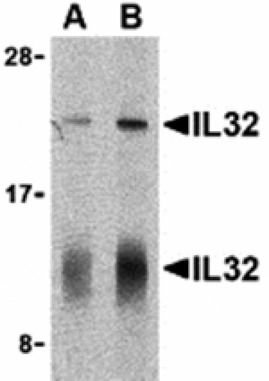 Western blot - IL-32 Antibody from Signalway Antibody (24392) - Antibodies.com