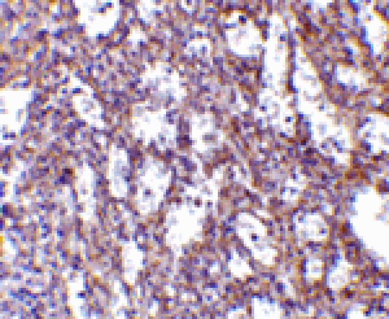 Immunohistochemistry - IL-32 Antibody from Signalway Antibody (24392) - Antibodies.com