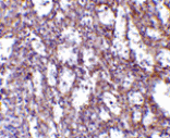 Immunohistochemistry - IL-32 Antibody from Signalway Antibody (24392) - Antibodies.com