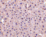 Immunohistochemistry - GAPDH Antibody from Signalway Antibody (24407) - Antibodies.com