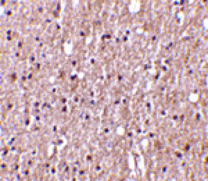 Immunohistochemistry - TWEAK Antibody from Signalway Antibody (24409) - Antibodies.com
