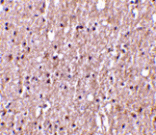 Immunohistochemistry - TWEAK Antibody from Signalway Antibody (24409) - Antibodies.com
