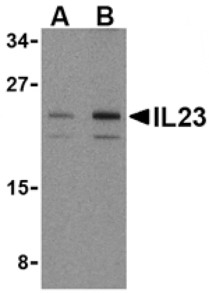 Western blot - IL-23 Antibody from Signalway Antibody (24411) - Antibodies.com