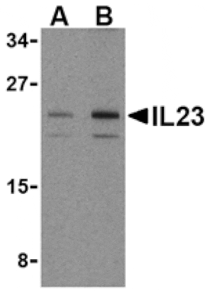 Western blot - IL-23 Antibody from Signalway Antibody (24411) - Antibodies.com