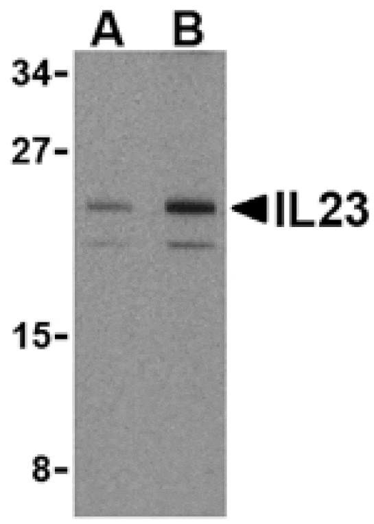 Western blot - IL-23 Antibody from Signalway Antibody (24411) - Antibodies.com