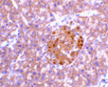 Immunohistochemistry - IL-23 Antibody from Signalway Antibody (24411) - Antibodies.com
