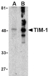 Western blot - TIM-1 Antibody from Signalway Antibody (24416) - Antibodies.com