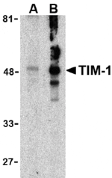Western blot - TIM-1 Antibody from Signalway Antibody (24416) - Antibodies.com