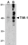 Western blot - TIM-1 Antibody from Signalway Antibody (24416) - Antibodies.com