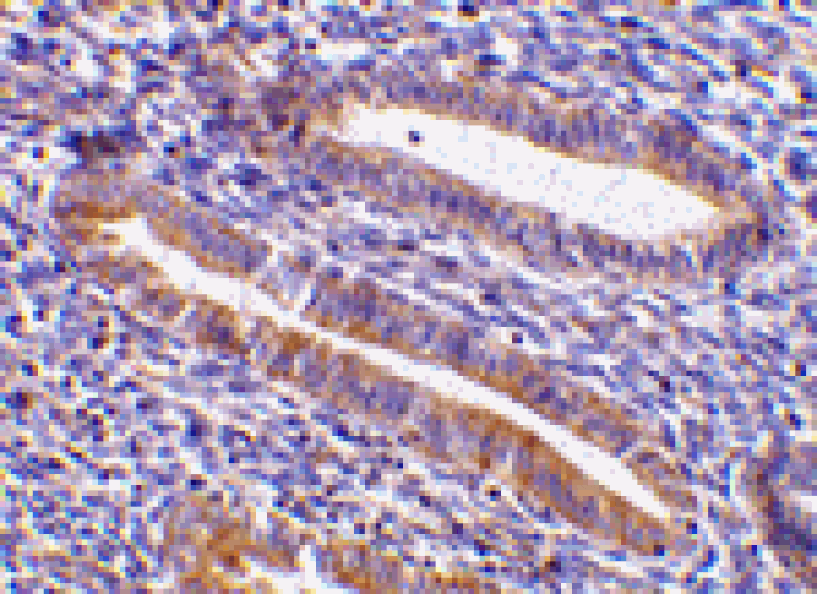 Immunohistochemistry - TIM-1 Antibody from Signalway Antibody (24416) - Antibodies.com