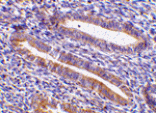 Immunohistochemistry - TIM-1 Antibody from Signalway Antibody (24416) - Antibodies.com