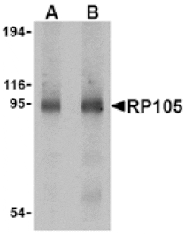 Western blot - RP105 Antibody from Signalway Antibody (24422) - Antibodies.com