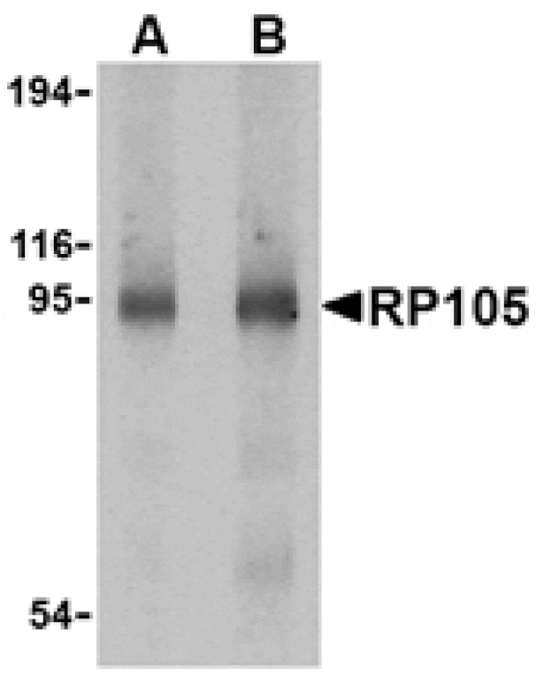 Western blot - RP105 Antibody from Signalway Antibody (24422) - Antibodies.com