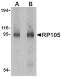 Western blot - RP105 Antibody from Signalway Antibody (24422) - Antibodies.com
