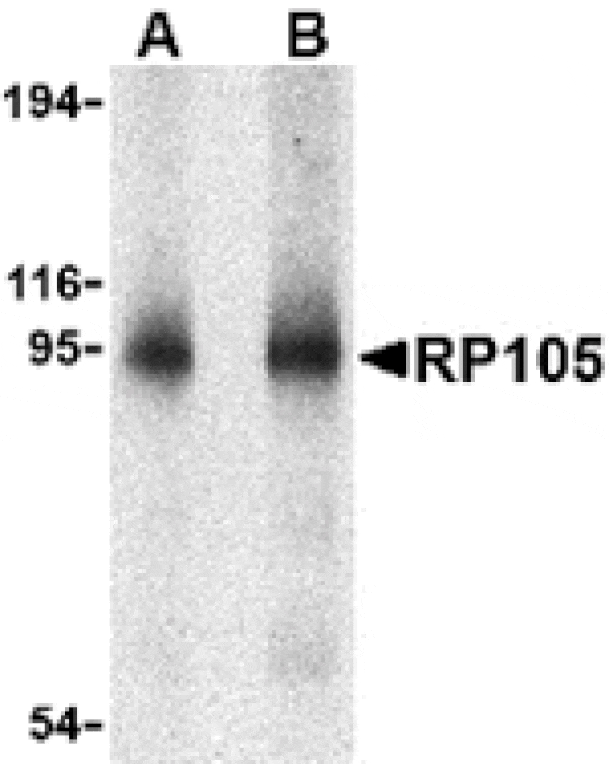 Western blot - RP105 Antibody from Signalway Antibody (24423) - Antibodies.com