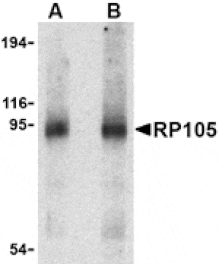 Western blot - RP105 Antibody from Signalway Antibody (24424) - Antibodies.com