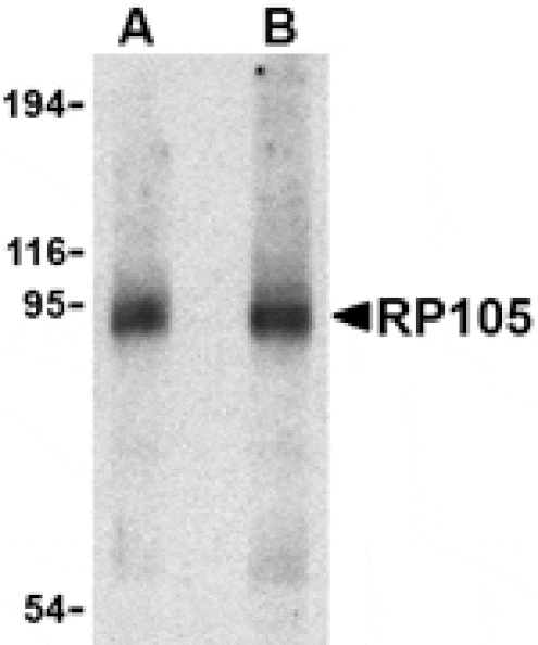 Western blot - RP105 Antibody from Signalway Antibody (24424) - Antibodies.com